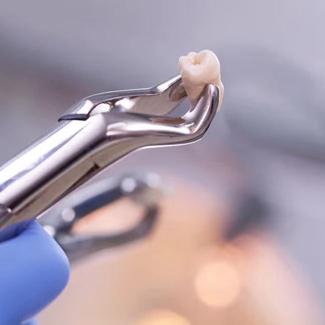 696858d38ff36831ffac33f8_service-thumbnail-extractions