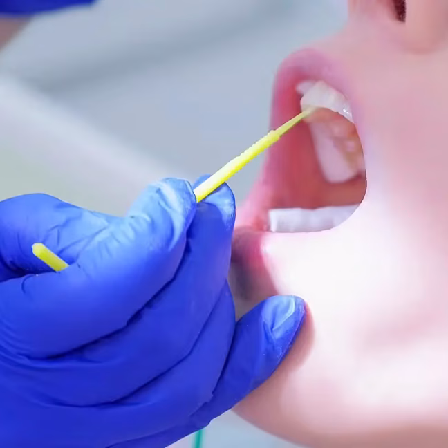 696858d4b470977206a59044_service-thumbnail-fluoride-treatments