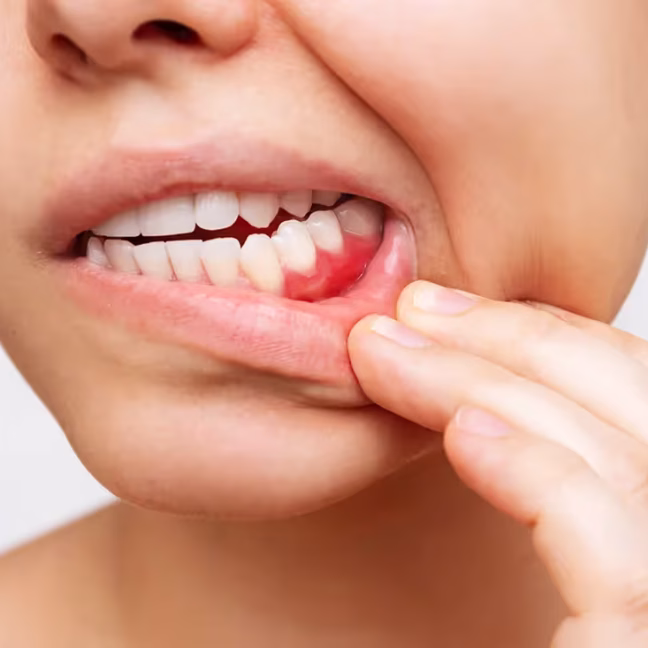 696858d69ab64c444d514151_service-thumbnail-periodontal-care (3)