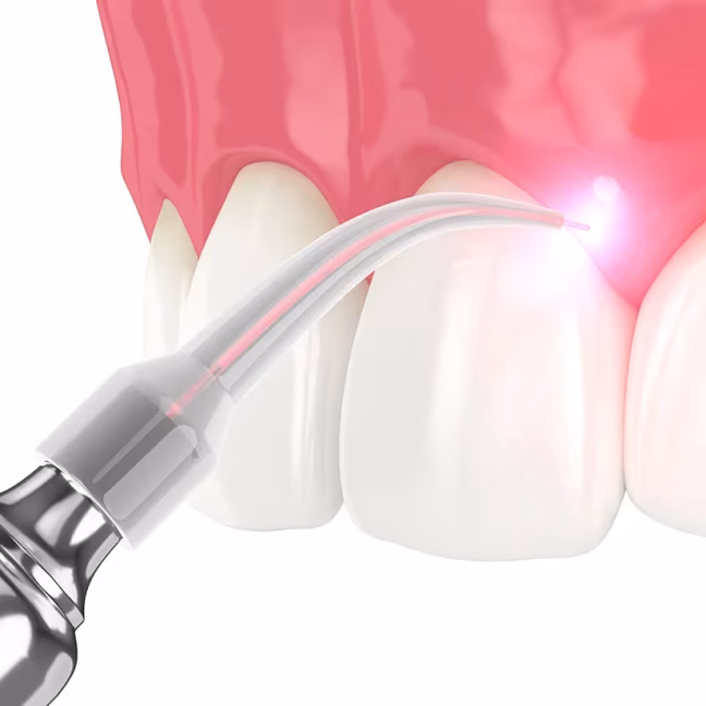 696858d833407af13b097d21_service-thumbnail-soft-tissue-laser-therapy