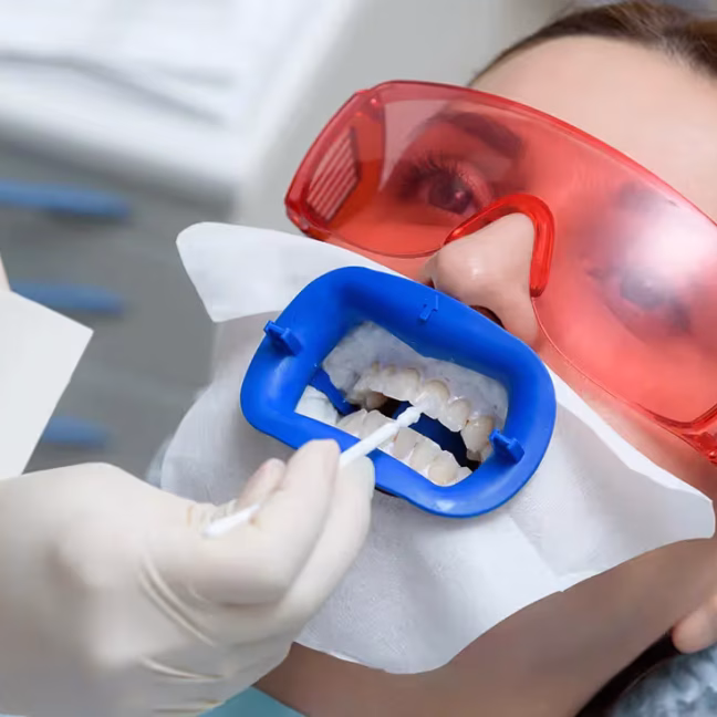 696858d948a1e9c1cb78abd3_service-thumbnail-teeth-whitening